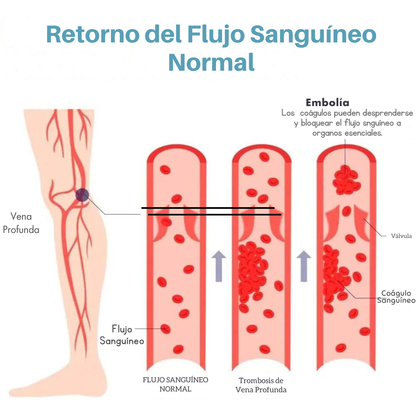PowerKnee - 2 Rodilleras de Compresión para deporte y recuperación.